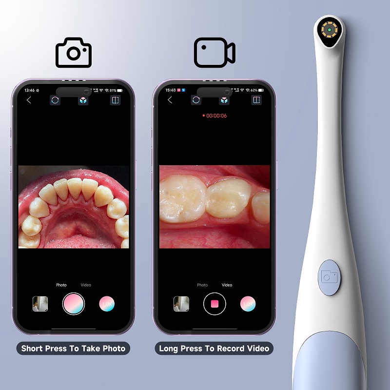 Oral Endoscope Camera 1440P Ph - Photography Lighting Diagram review and price